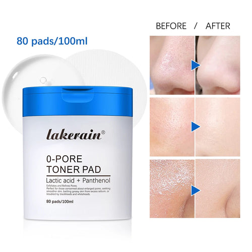 AHA BHA Zero Pore Exfoliating Pads – Double-Textured Toner Pads for Smoother, Refined Skin (70 Pads)