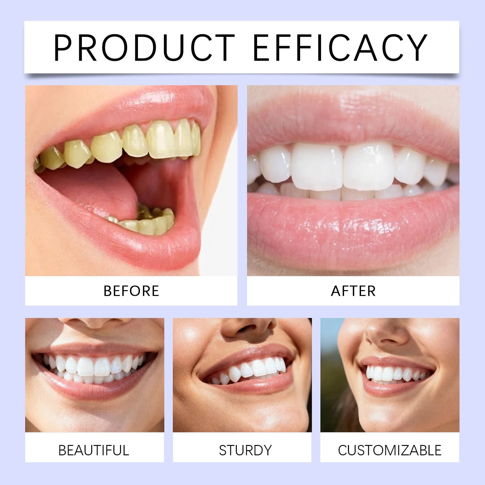 Purple Teeth Whitening Strips – Gentle Stain Removal for a Brighter Smile (14 Strips)